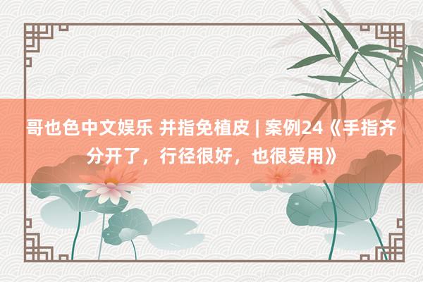 哥也色中文娱乐 并指免植皮 | 案例24《手指齐分开了，行径很好，也很爱用》